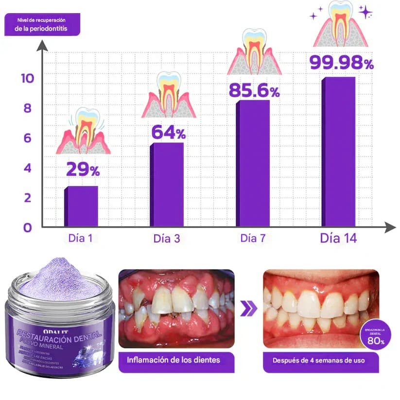 Teeth Restoration - Polvo para Dientes