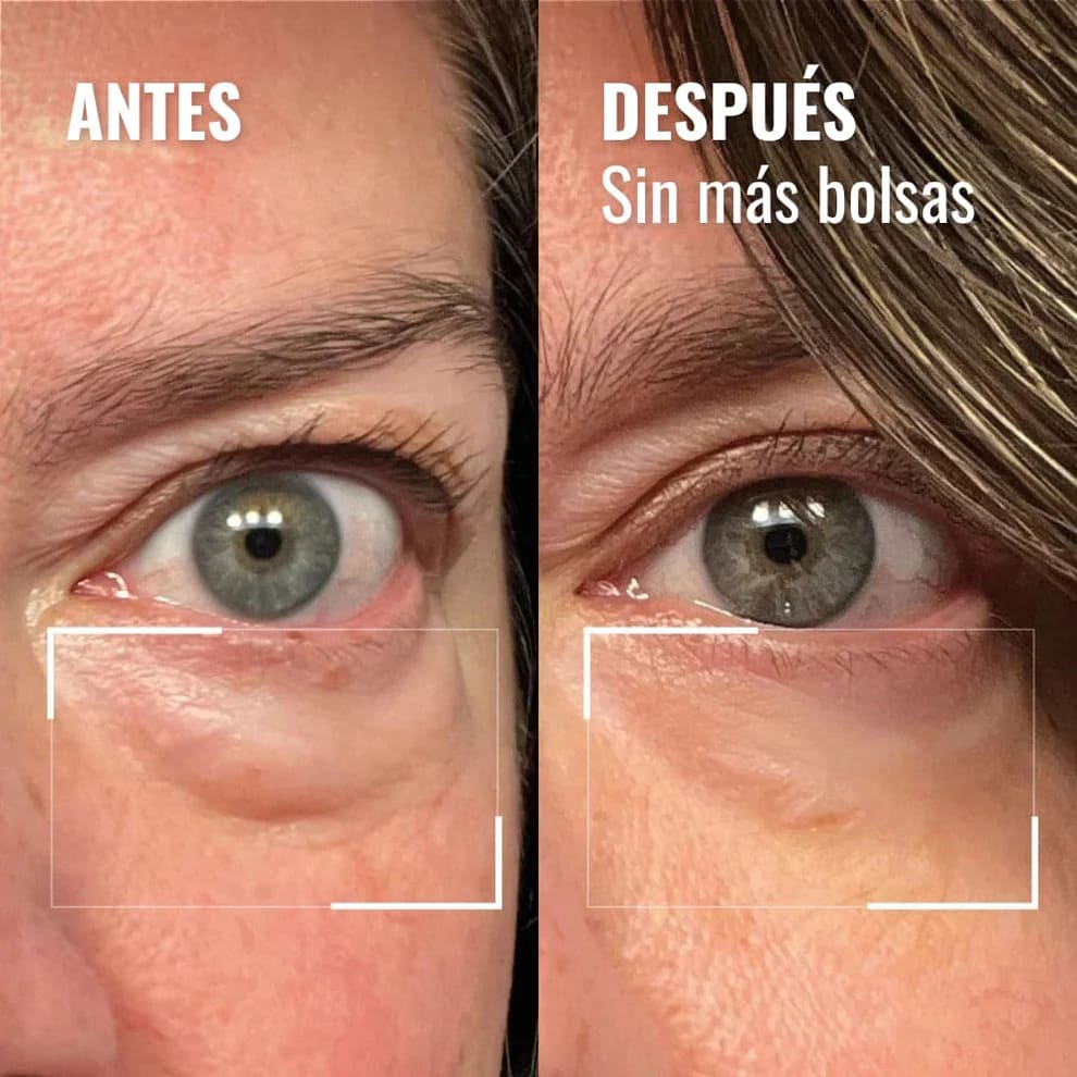 Crema + Masajeador de Ojos YCZ | Elimina el aspecto cansado de tu rostro.