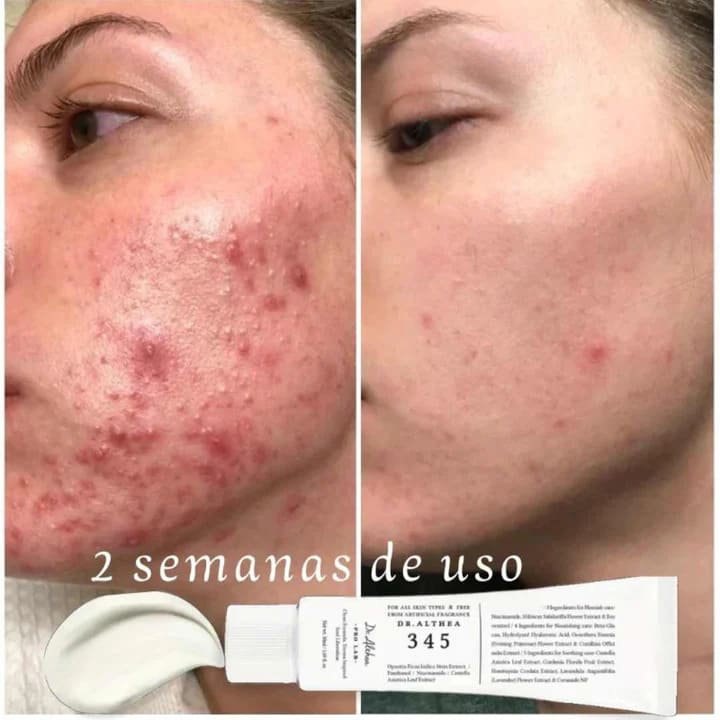 Dr. Althea 345 Relief Cream – Tu Piel Sin Manchas