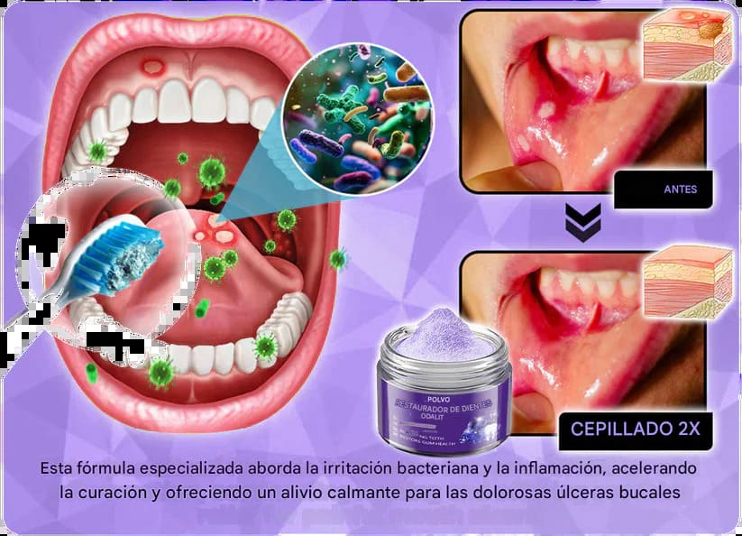 Teeth Restoration - Polvo para Dientes